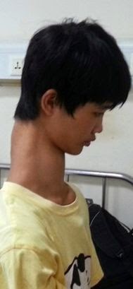 Photos: Meet the teenager with the longest neck in the world